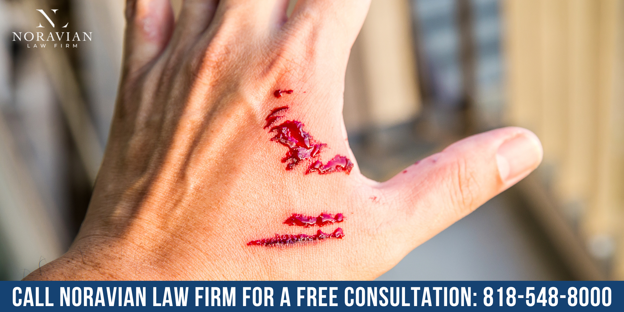 glendale dog bite lawyer